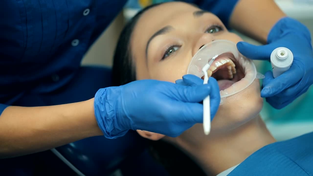 Download Stock Video Dentist Hands Cleaning Teeth To A Patient Live Wallpaper For PC