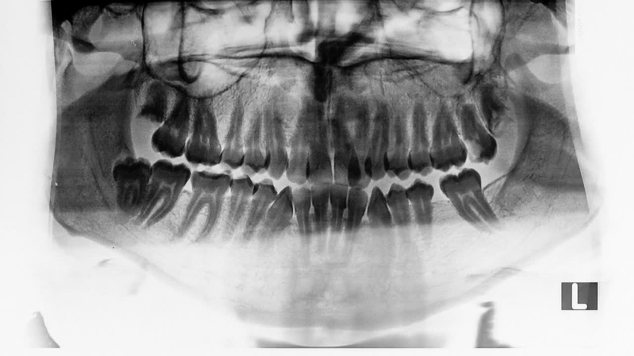 Download Stock Video Dental X Ray Live Wallpaper For PC