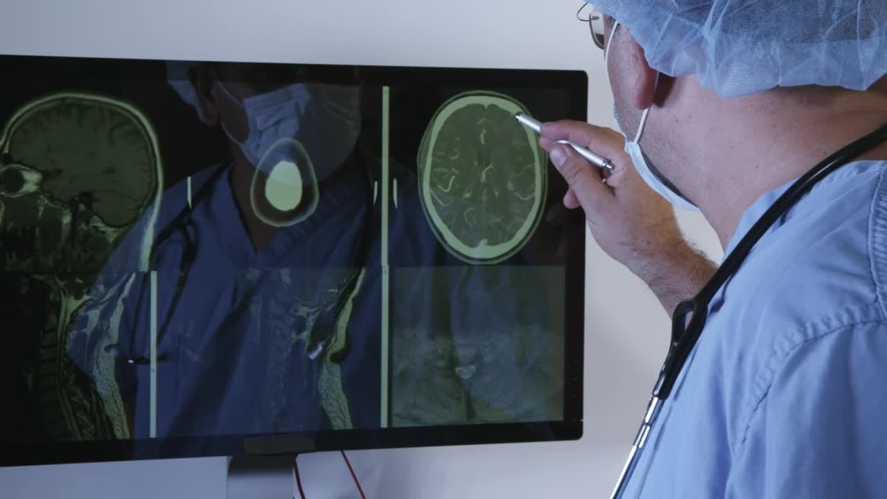 Download Stock Video Doctor Reviewing A Brain Scan Live Wallpaper For PC