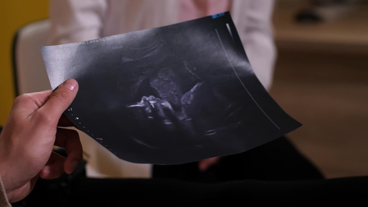 Download Stock Video Parents Holding An Ultrasound Photo Live Wallpaper