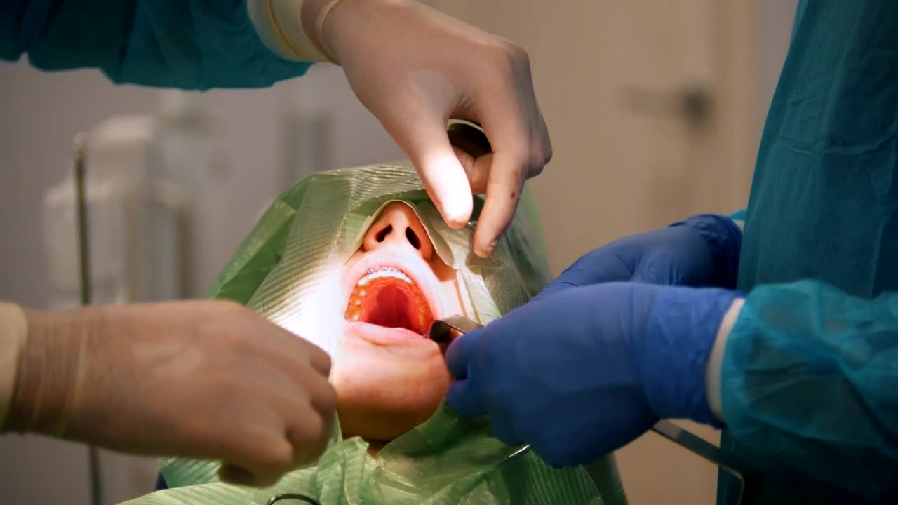 Download Free Video Stock surgeons working on a patients mouth Live Wallpaper